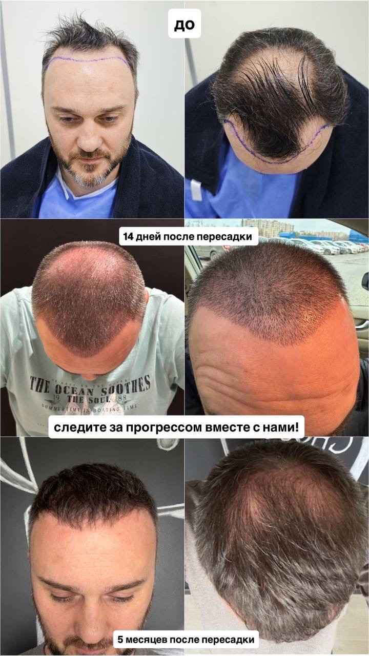 нормальный прогресс или нет.jpg