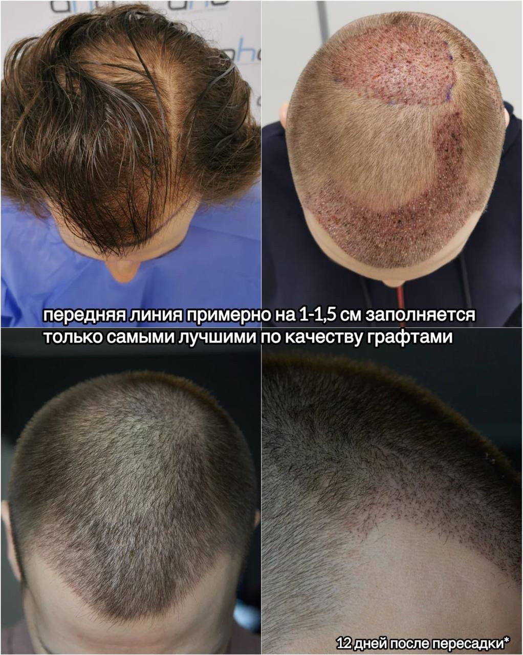 snD2hHhzPmklB5zeiaZcHLT4gbqOe3Uv-Lz-gICwSVriKGhhigJOwbsZUMytoR6SYcFrbtaUF9zRta1DQPsBKpI1.jpg