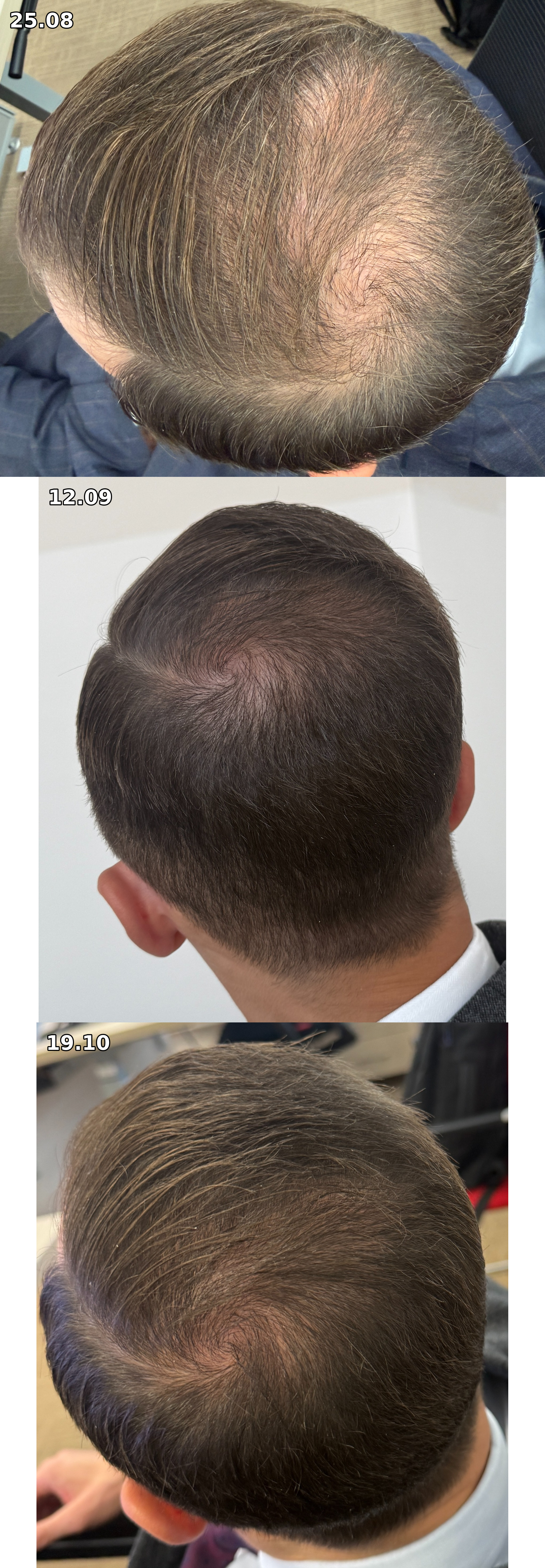 hair_progress_vertical_collage.jpg